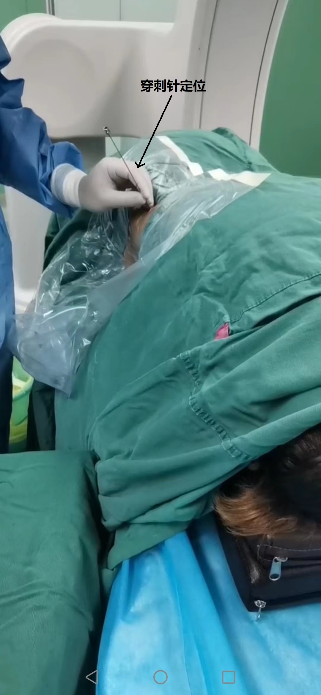 1-穿刺针-定位.jpg